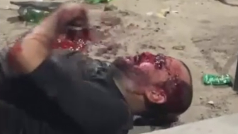 Man Suffers After Being Beaten And Stabbed During A Drunk Fight