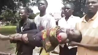 Crocodile Ripped Woman`s Arm Off In Zambia