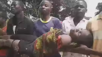 Crocodile Ripped Woman`s Arm Off In Zambia