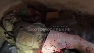 Wounded Russian soldier hospitalized in the front