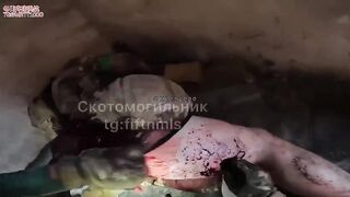Wounded Russian soldier hospitalized in the front