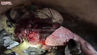 Wounded Russian soldier hospitalized in the front
