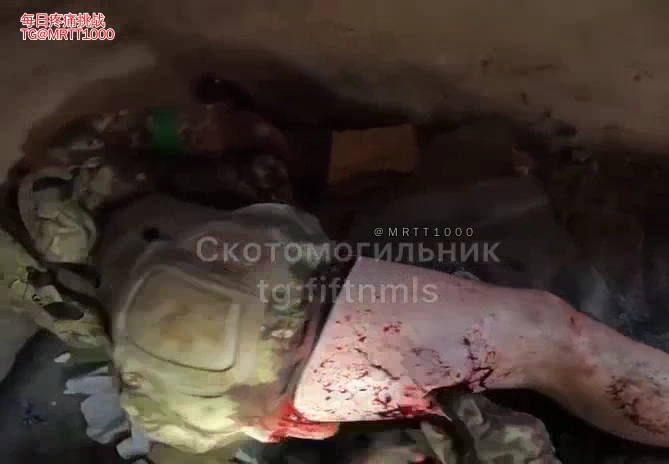 Wounded Russian soldier hospitalized in the front