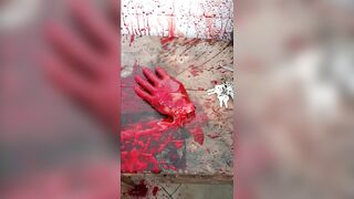 Man with Mental Breakdown Severs His Own Hand with Machete and Collapses in Agony