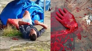 Man with Mental Breakdown Severs His Own Hand with Machete and Collapses in Agony