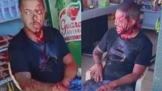 Shocked Employee Bleeding After Being Hacked  During Robbery