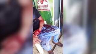 Shocked Employee Bleeding After Being Hacked  During Robbery