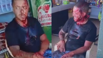 Shocked Employee Bleeding After Being Hacked  During Robbery