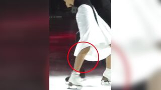 Russian figure skater's partner cuts leg