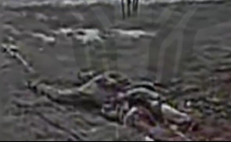 Removal of Ukrainian legs.