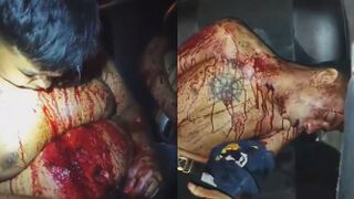 This Is How "Thug Life" Ends