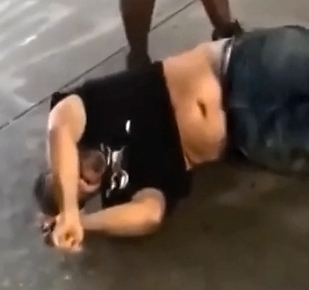 Drunk show-off ends in broken cervical vertebra and paralysis