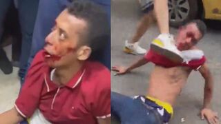 Thief Having A Painful Day In Colombia