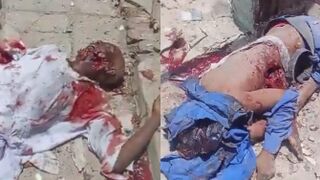 Seven Killed After RSF Attacked Hospital In South Sudan