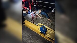 Woman Loses Control of Scooter, Crashes Into Metal Barrier Dies Instantly