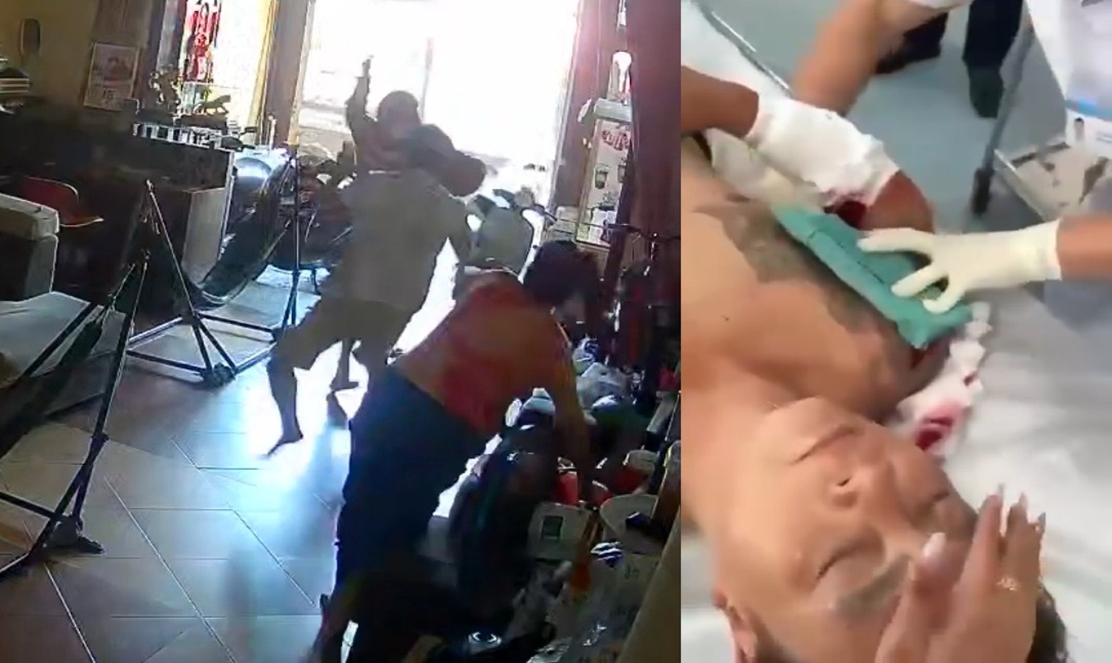 Machete Revenge: Man Stabbed in Home Over Ancient Rivalry