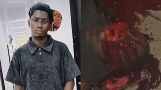 Accident Victim Vomits Blood In Terrible Agony