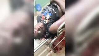 Accident Victim Vomits Blood In Terrible Agony