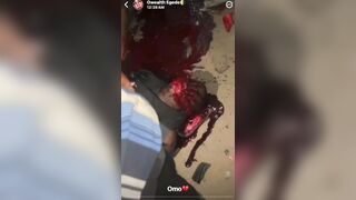 Accident Victim Vomits Blood In Terrible Agony