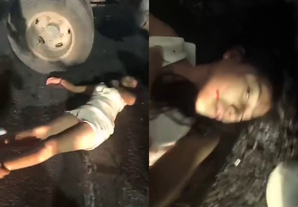 Dude Dies on the Spot as Girlfriend Fights for Life After Motorcycle Hits Truck