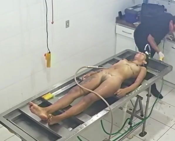 Strangled Young Woman Being Embalmed at Morgue