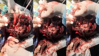 the burned face of a Russian soldier