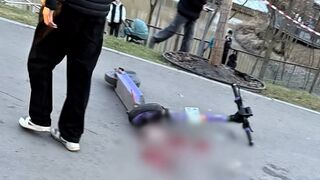 Elderly man suffers open fracture in Moscow