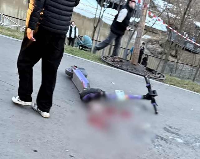 Elderly man suffers open fracture in Moscow