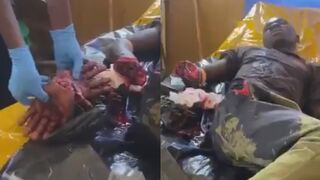 Farmers Caught A Thief And Chopped Both His Palms Off