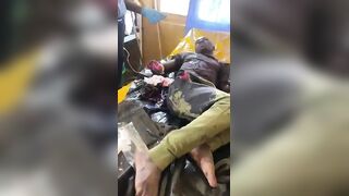 Farmers Caught A Thief And Chopped Both His Palms Off