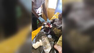 Farmers Caught A Thief And Chopped Both His Palms Off