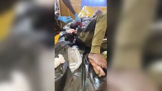 Farmers Caught A Thief And Chopped Both His Palms Off