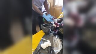 Farmers Caught A Thief And Chopped Both His Palms Off