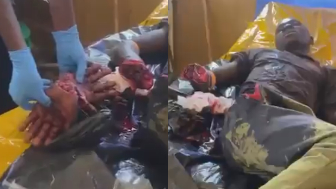 Farmers Caught A Thief And Chopped Both His Palms Off