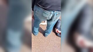 Woman Suffers Terrible Leg Injury Fully Awake