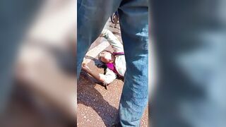 Woman Suffers Terrible Leg Injury Fully Awake