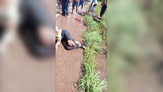 Woman Suffers Terrible Leg Injury Fully Awake