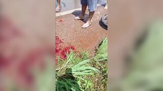 Woman Suffers Terrible Leg Injury Fully Awake