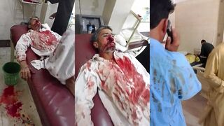 Nose obliterated in accident