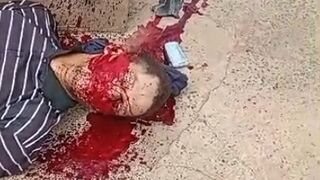 Motorcyclist Bleeding Out on the Pavement – Nose and Mouth Pouring Blood