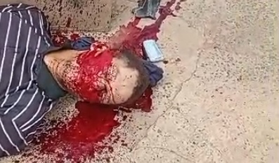 Motorcyclist Bleeding Out on the Pavement – Nose and Mouth Pouring Blood