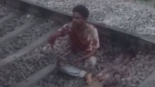 Man`s Hand RIpped Off By Train