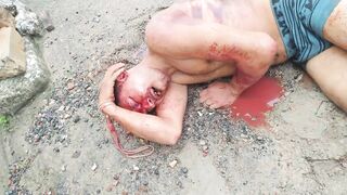 Son Grabs Stick and Nearly Kills Intruder Who Brutally Assaulted Grandma & Sister