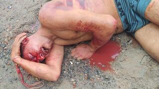 Son Grabs Stick and Nearly Kills Intruder Who Brutally Assaulted Grandma & Sister