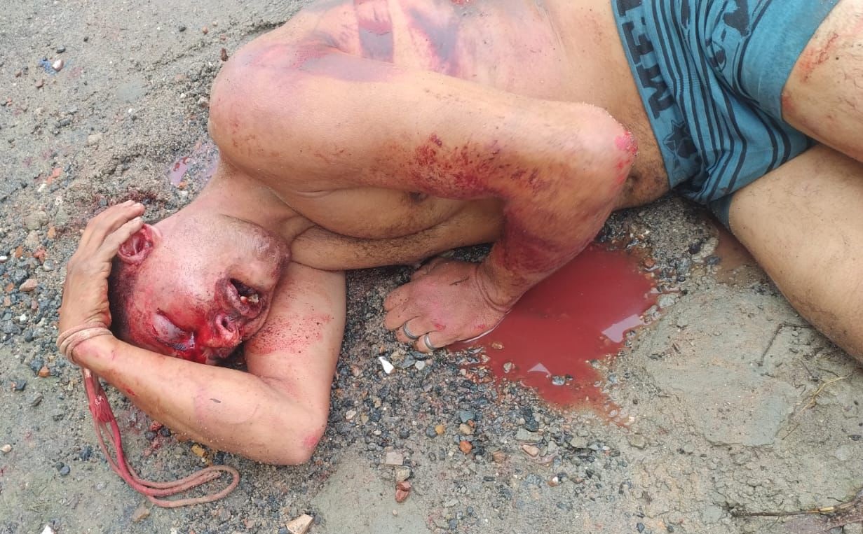 Son Grabs Stick and Nearly Kills Intruder Who Brutally Assaulted Grandma & Sister