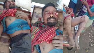 Villagers beat thief aftermath