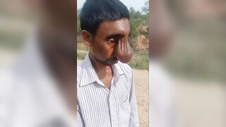 What's That On That Guy's Forehead?