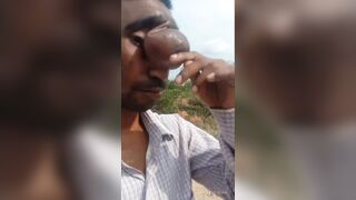 What's That On That Guy's Forehead?
