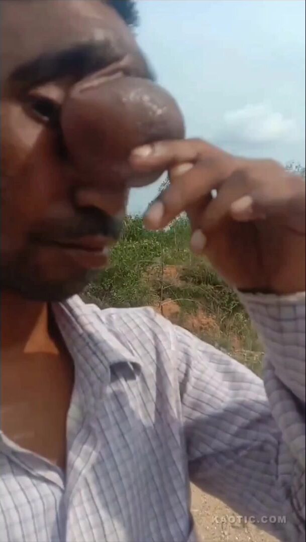 What's That On That Guy's Forehead?