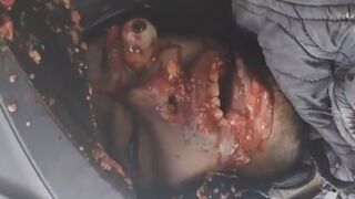 Motorcyclist Killed By Garbage Truck In Colombia